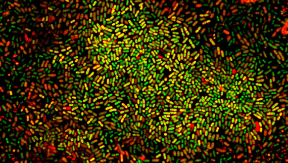 Bacterias con tinte amarelo e vermello